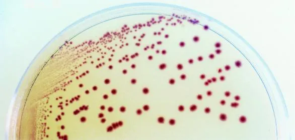 PCR: Cara Akurat Cek Penyakit Udang Vaname