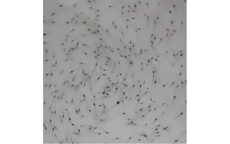 Bibit Udang Berkualitas untuk Budidaya Sukses dan Menguntungkan