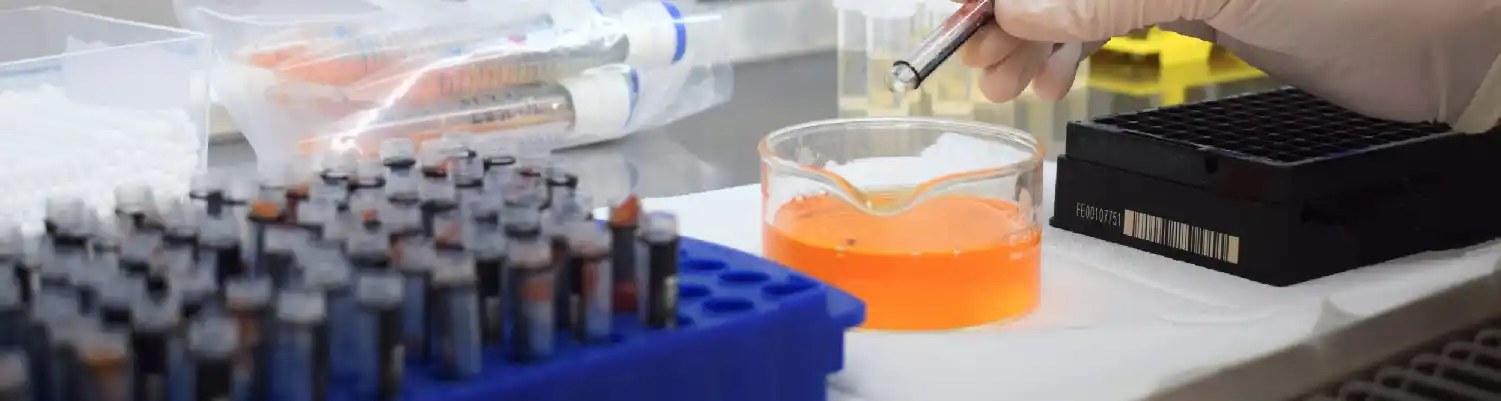 6 Kriteria Laboratorium Penyakit Udang yang Wajib Diketahui Petambak